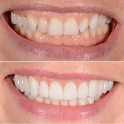 Bespoke Smile Marlow