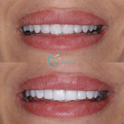 Care Dental Smile