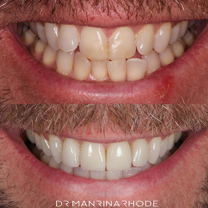 DRMR Clinic | Veneers London