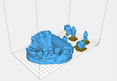 Elvin Incisal Dental Lab