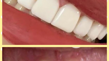 Emergency Dentist London 24/7 Open