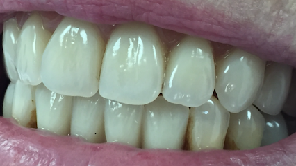 International Smiles