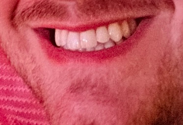 Oradent Dental Care - City Way