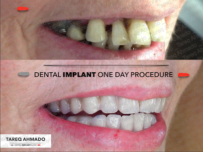 Tareq Ahmado - Laser Dentist & MSc Dental Implants