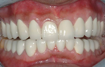 The Dental Implant Group